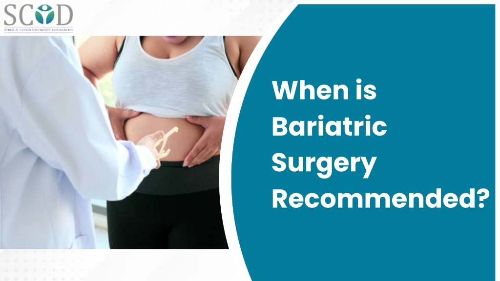 When is Bariatric Surgery Recommended?