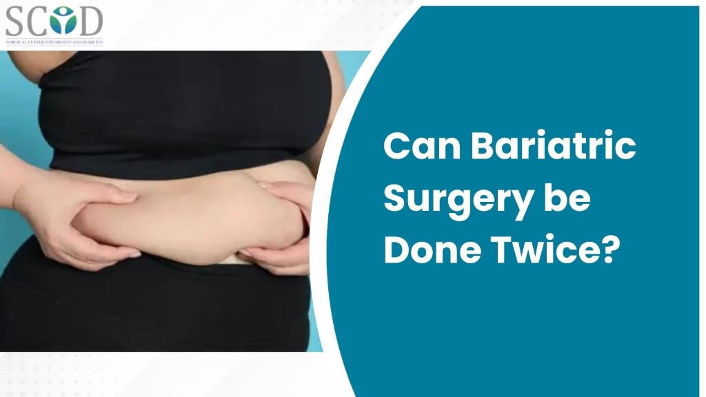 Can Bariatric Surgery be Done Twice?