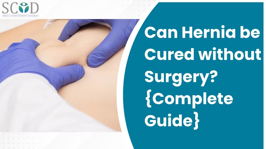 Can Hernia be Cured without Surgery? Complete Guide