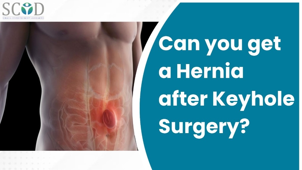 Can you get a Hernia after Keyhole Surgery?