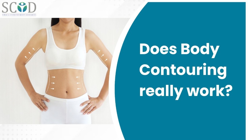 Does Body Contouring Really Work? - SCOD Clinic