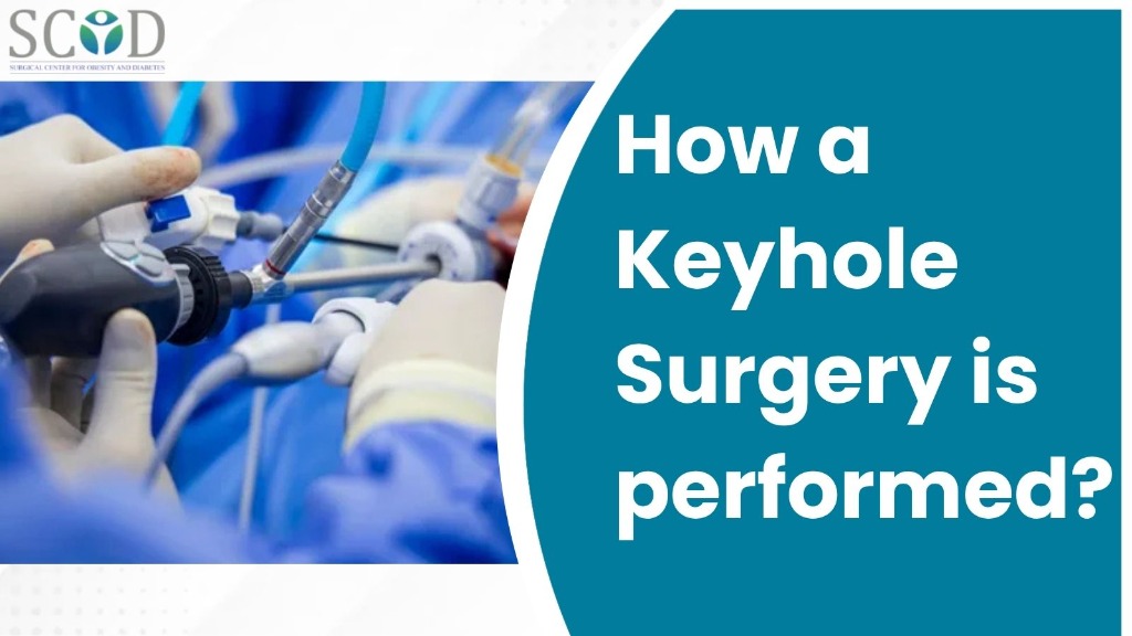 How a Keyhole Surgery is performed?