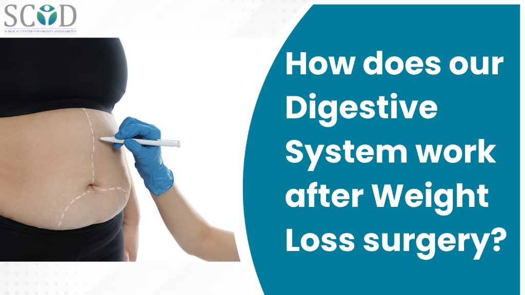 How does our Digestive System work after Weight Loss surgery?
