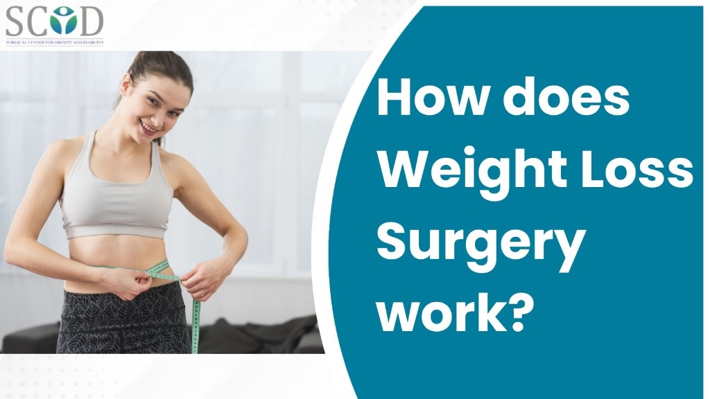 How does Weight Loss Surgery work?