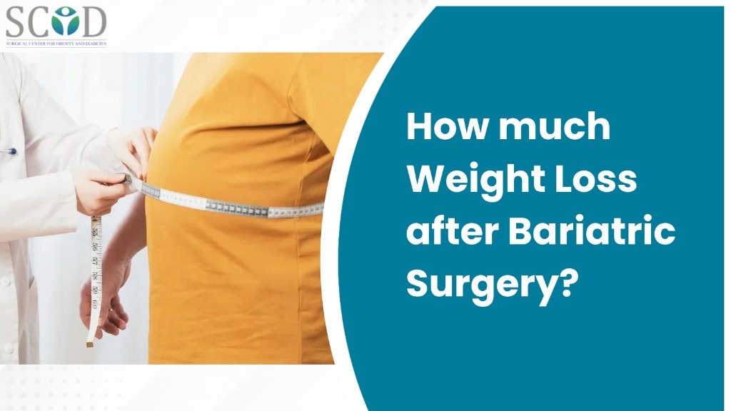 How Much Weight Loss After Bariatric Surgery?