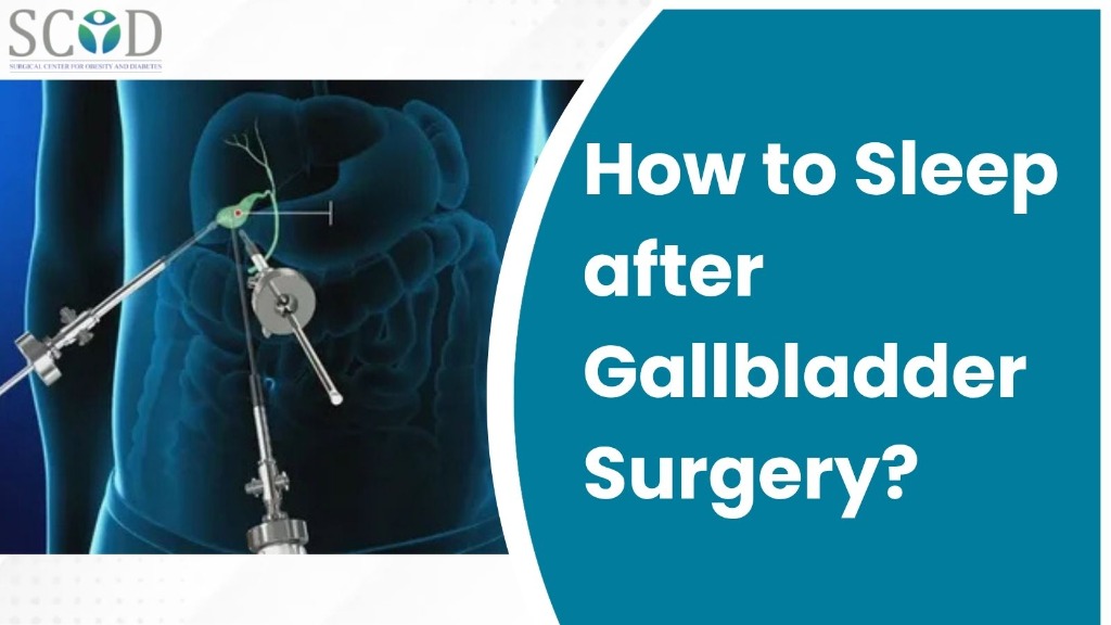 How to Sleep after Gallbladder Surgery?