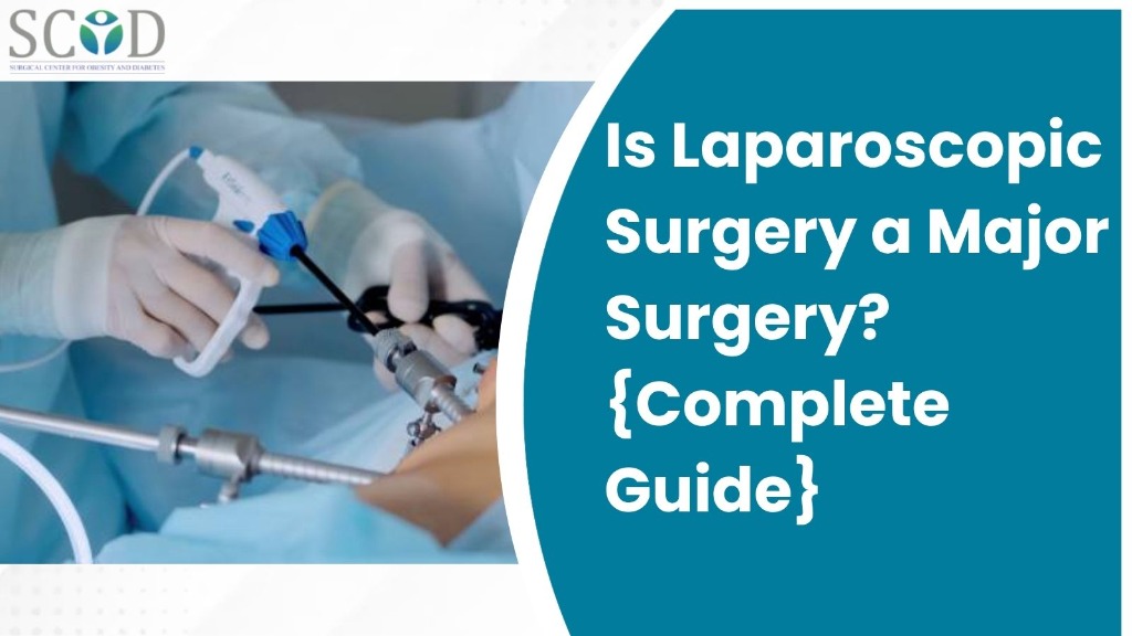 Is Laparoscopic Surgery a Major Surgery? {Complete Guide}