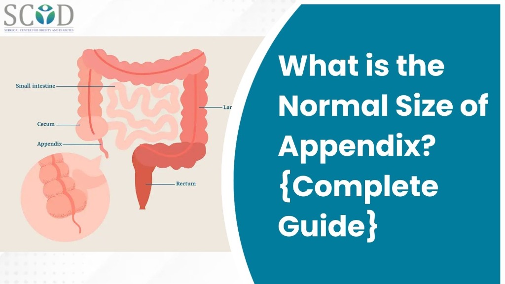 What is the Normal Size of Appendix? Complete Guide