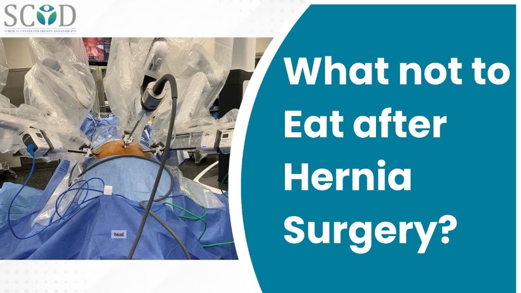 What not to Eat after Hernia Surgery?
