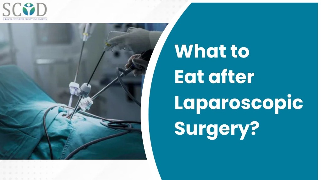 What to Eat after Laparoscopic Surgery?