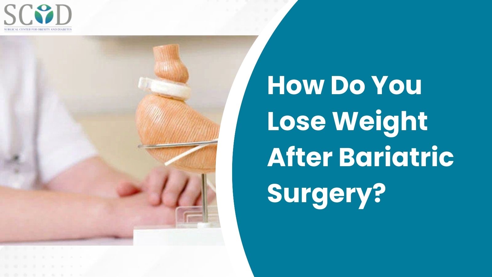 How Do You Lose Weight After Bariatric Surgery