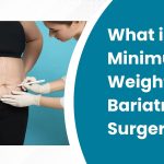 Minimum Weight for Bariatric Surgery