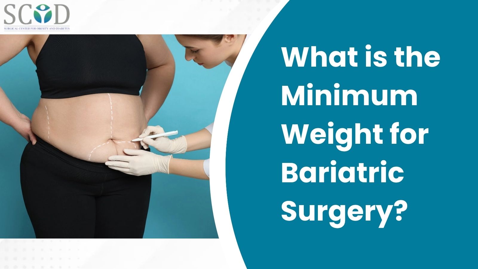 Minimum Weight for Bariatric Surgery