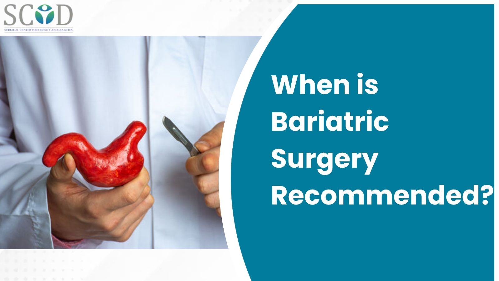 When is Bariatric Surgery Recommended