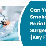 Can You Smoke After Bariatric Surgery
