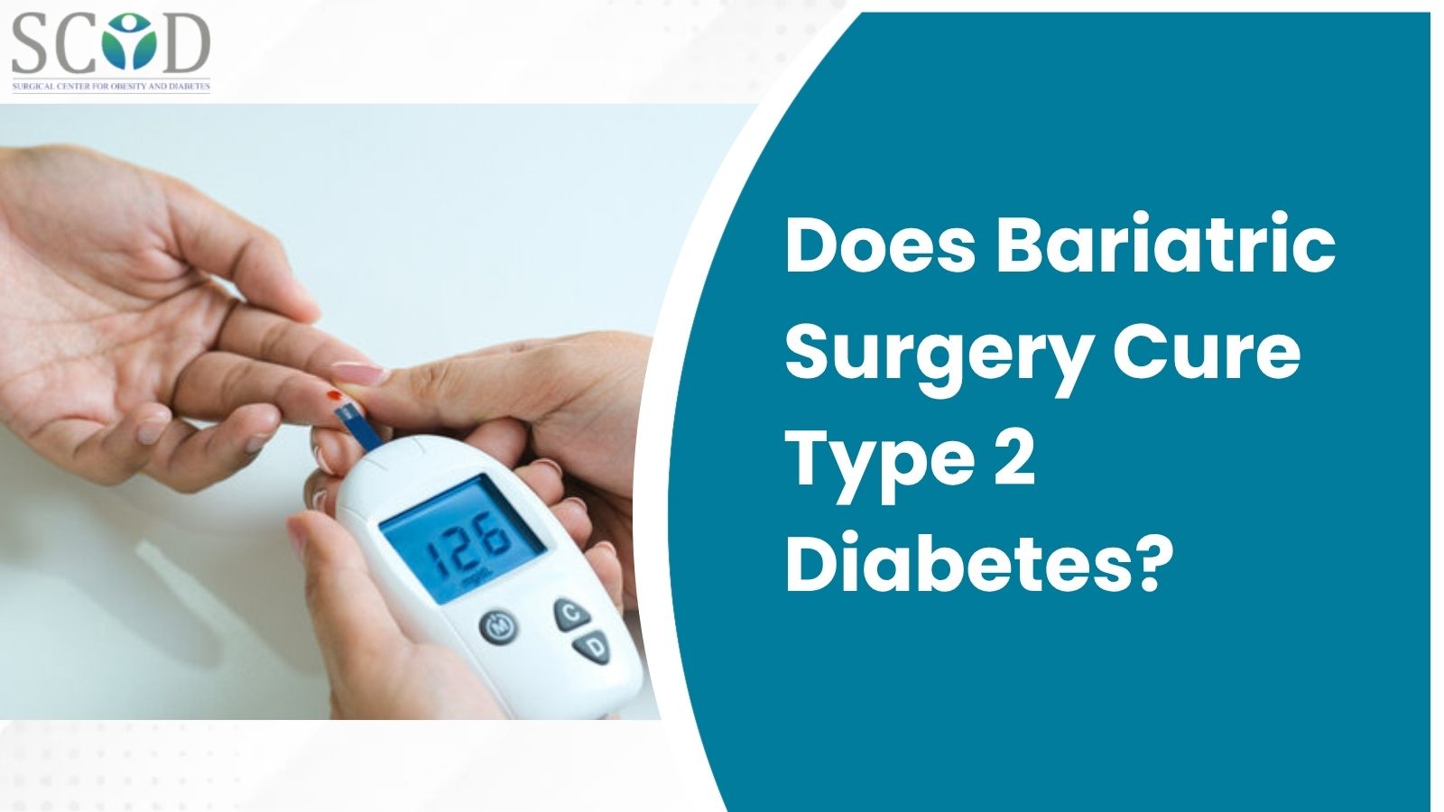 Does Bariatric Surgery Cure Type 2 Diabetes