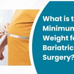 What is the Minimum Weight for Bariatric Surgery